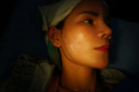 ปัญหาจากการฉีดฟิลเลอร์ปลอม