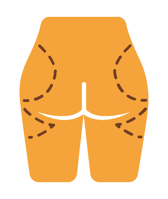 ต้นขาและสะโพก